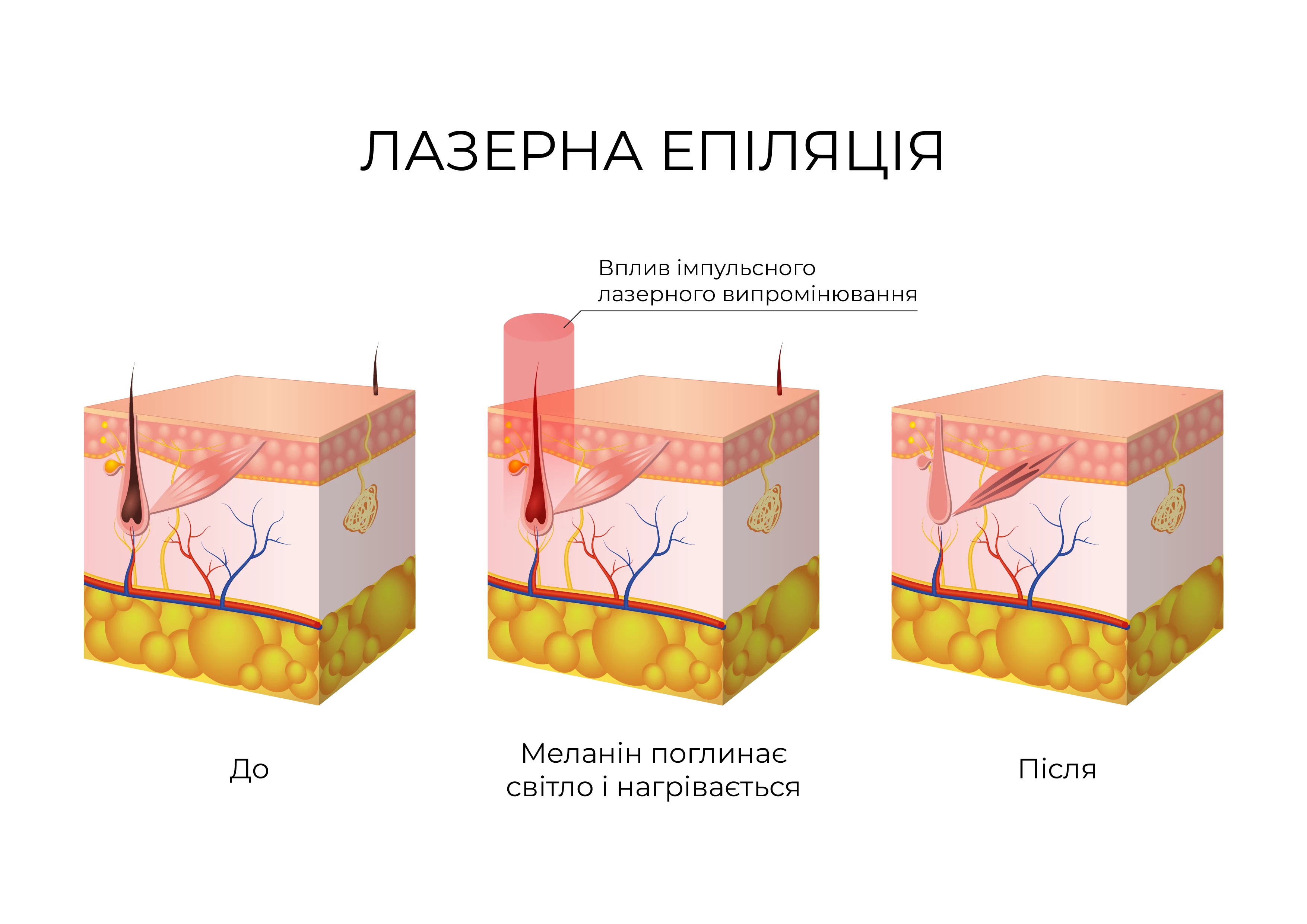 Принцип дії